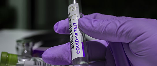 Narrow-Block-Herraj A hand in purple gloves holding a COVID-19 test tube in a lab setting.